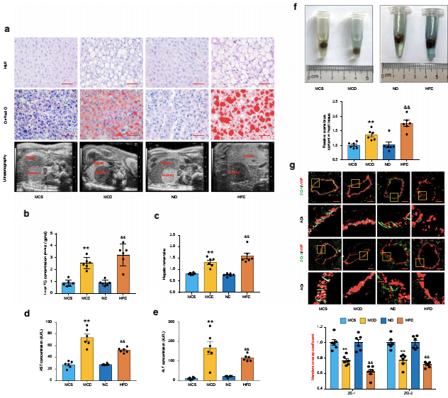 NAFLD小鼠冠狀動脈微血管內(nèi)皮通透性增強(qiáng)