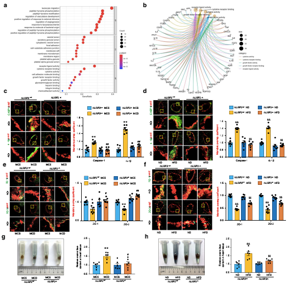NLRP3炎癥小體介導(dǎo)NAFLD小鼠冠狀動脈微血管內(nèi)皮高通透性