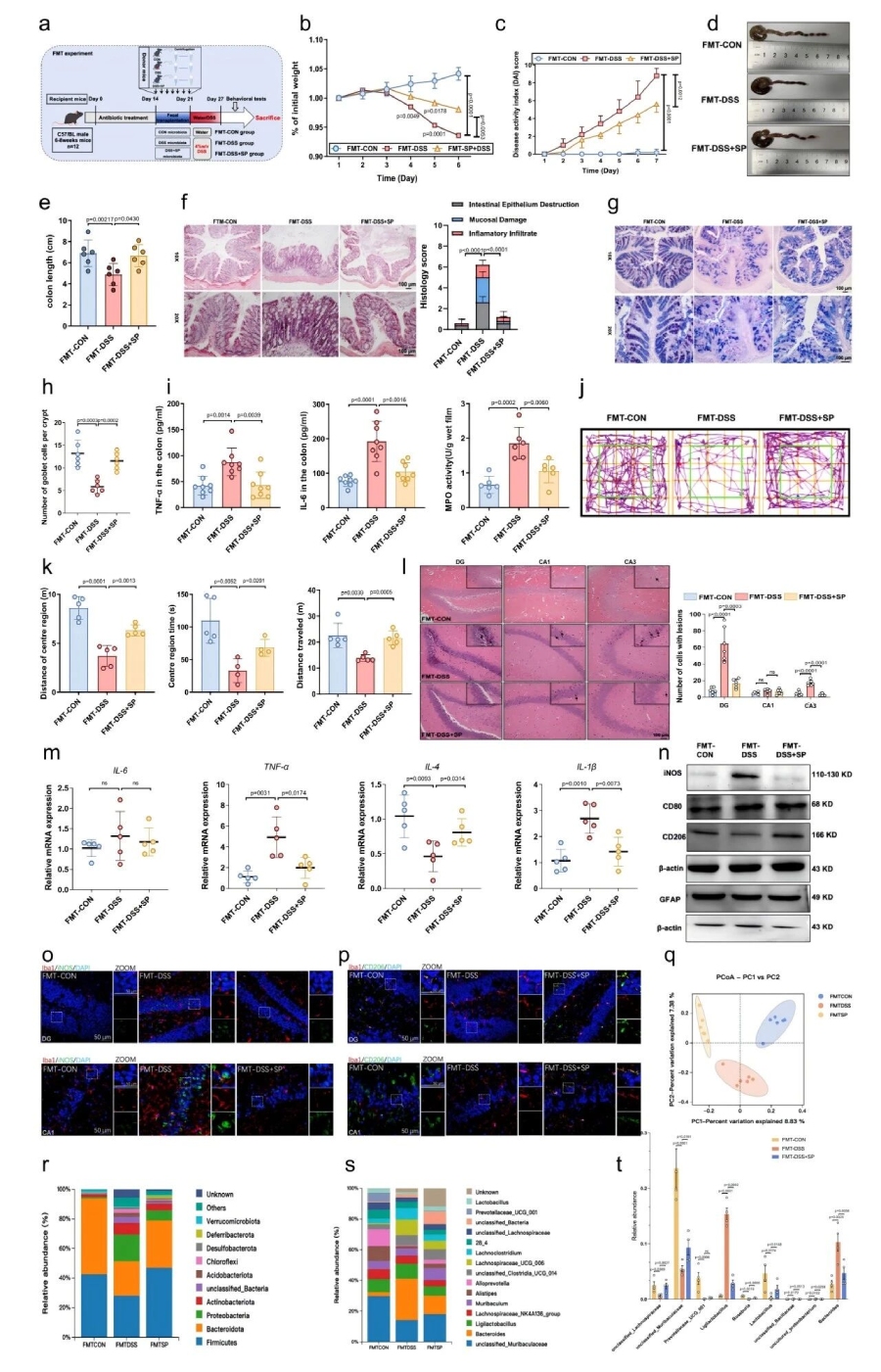 圖5 FMT實驗表明SP通過調(diào)節(jié)腸道菌群減輕了DSS誘導(dǎo)的結(jié)腸炎和焦慮樣行為